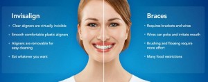 Cosmetic dental braces